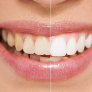 Estetica Dentale