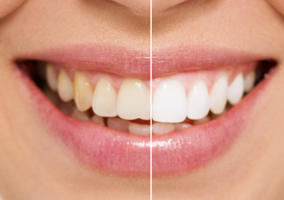 Estetica Dentale